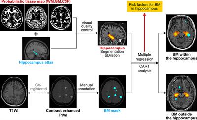 Hippocampal Metastasis Rate Based on Non-Small Lung Cancer TNM Stage and Molecular Markers